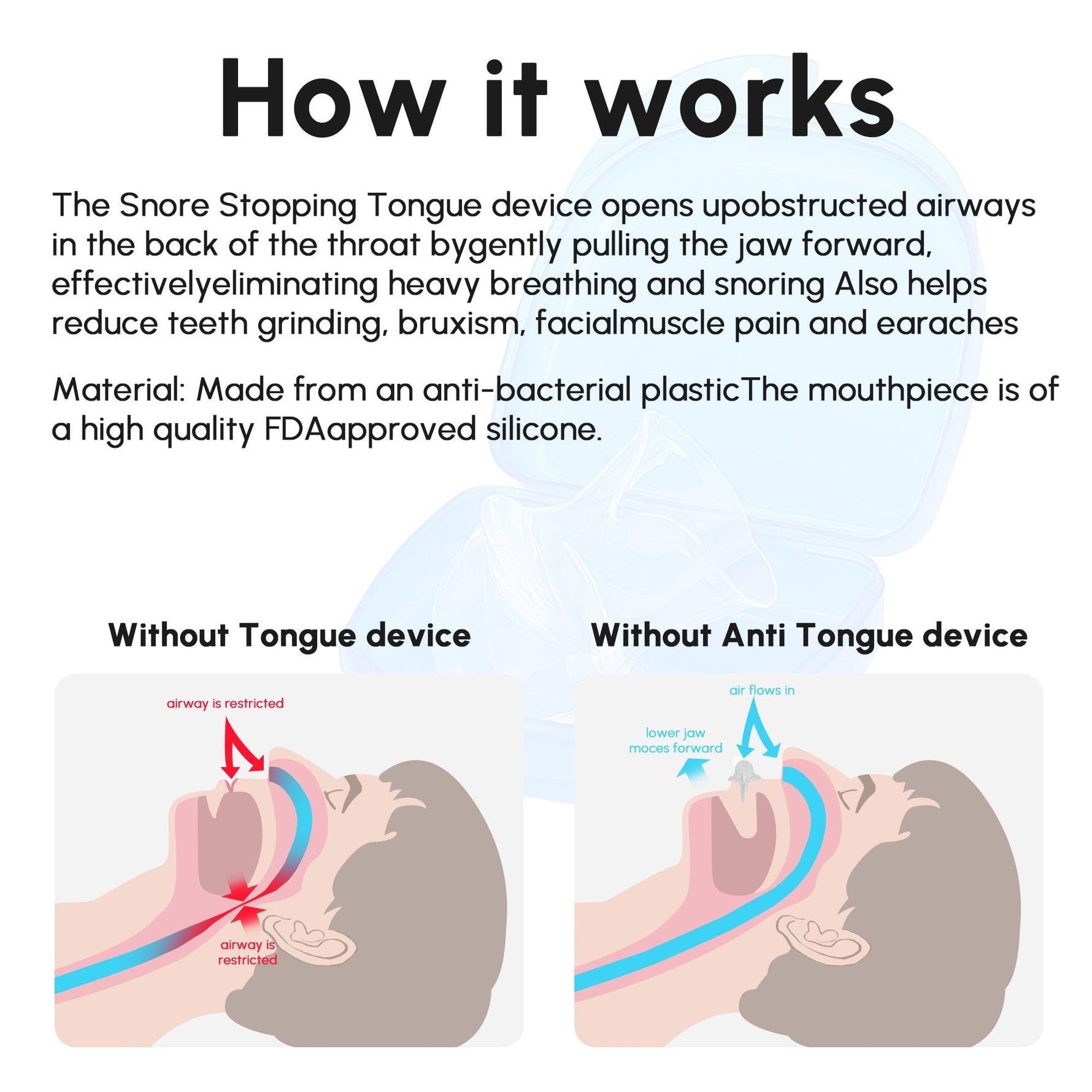 SilentNight Anti - Snoring Aid